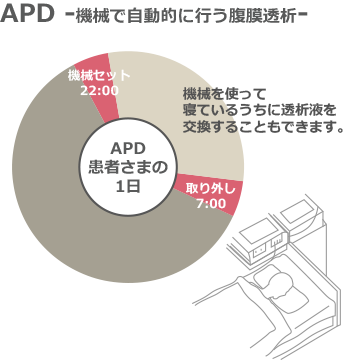 APD -機械で自動的に行う腹膜透析-